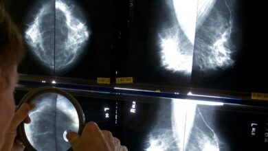 Some breast cancer patients can avoid certain surgeries, studies suggest