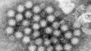 Nasty norovirus is back in full force with US cases of the stomach virus surging