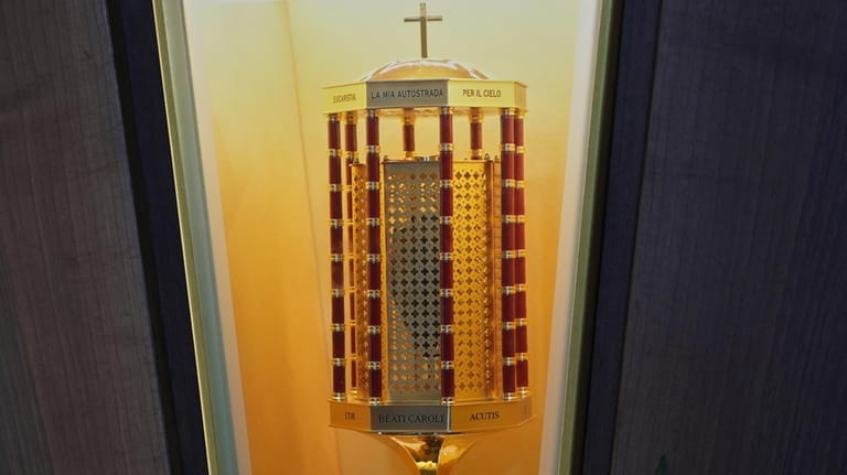 You shouldn’t buy a piece of a saint. Catholic Church denounces online sale of Carlo Acutis relics You shouldn’t buy a piece of a saint. Catholic Church denounces online sale of Carlo Acutis relics